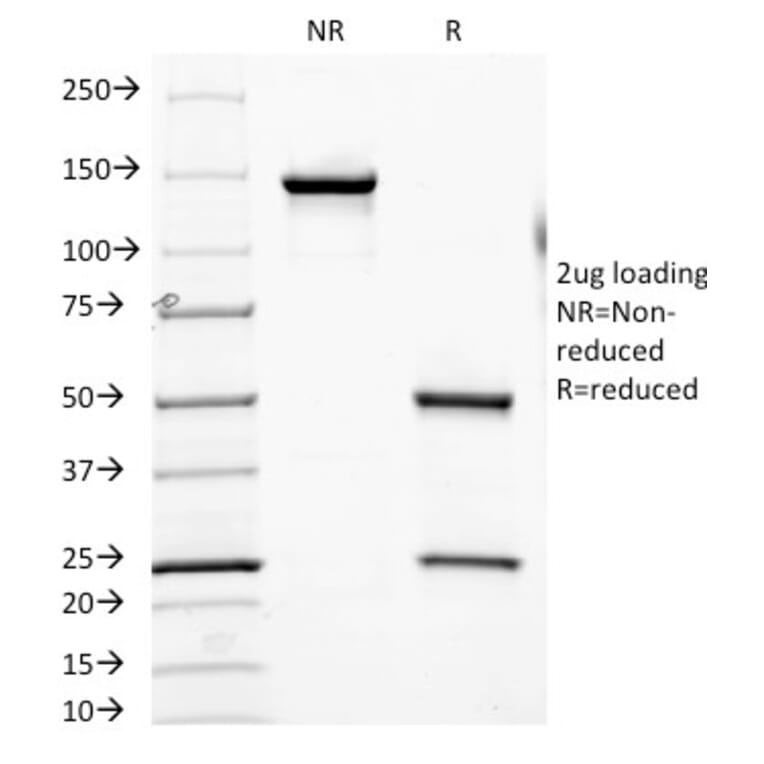 SDS-PAGE - Anti-PSMA Antibody [FOLH1/2354] (A248604) - Antibodies.com