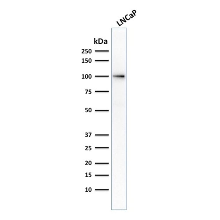 Western Blot - Anti-PSMA Antibody [FOLH1/2354] (A248604) - Antibodies.com