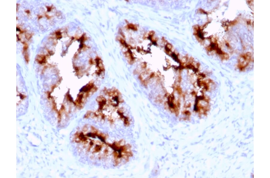 Immunohistochemistry - Anti-PSMA Antibody [FOLH1/2363] (A248605) - Antibodies.com
