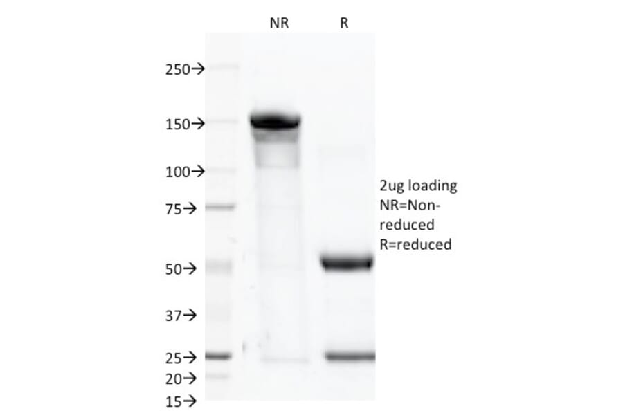 SDS-PAGE - Anti-PSMA Antibody [FOLH1/2363] (A248605) - Antibodies.com