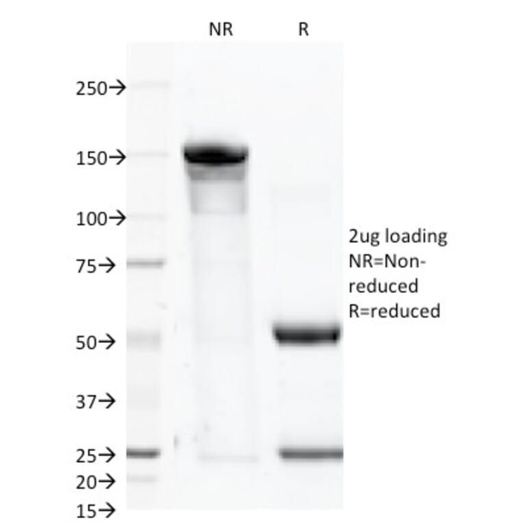 SDS-PAGE - Anti-PSMA Antibody [FOLH1/2363] (A248605) - Antibodies.com