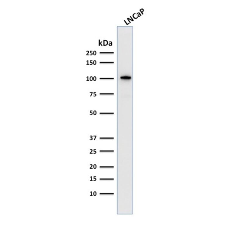 Western Blot - Anti-PSMA Antibody [FOLH1/2363] (A248605) - Antibodies.com