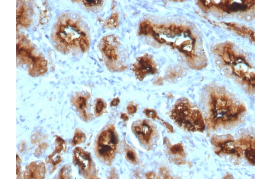 Immunohistochemistry - Anti-PSMA Antibody [SPM500] (A248605) - Antibodies.com