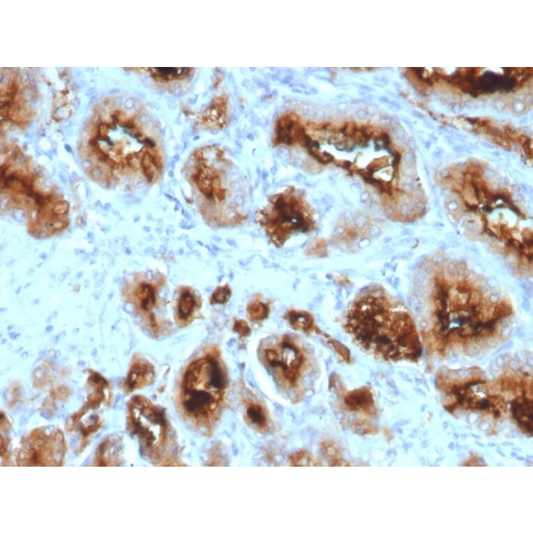 Immunohistochemistry - Anti-PSMA Antibody [SPM500] (A248605) - Antibodies.com