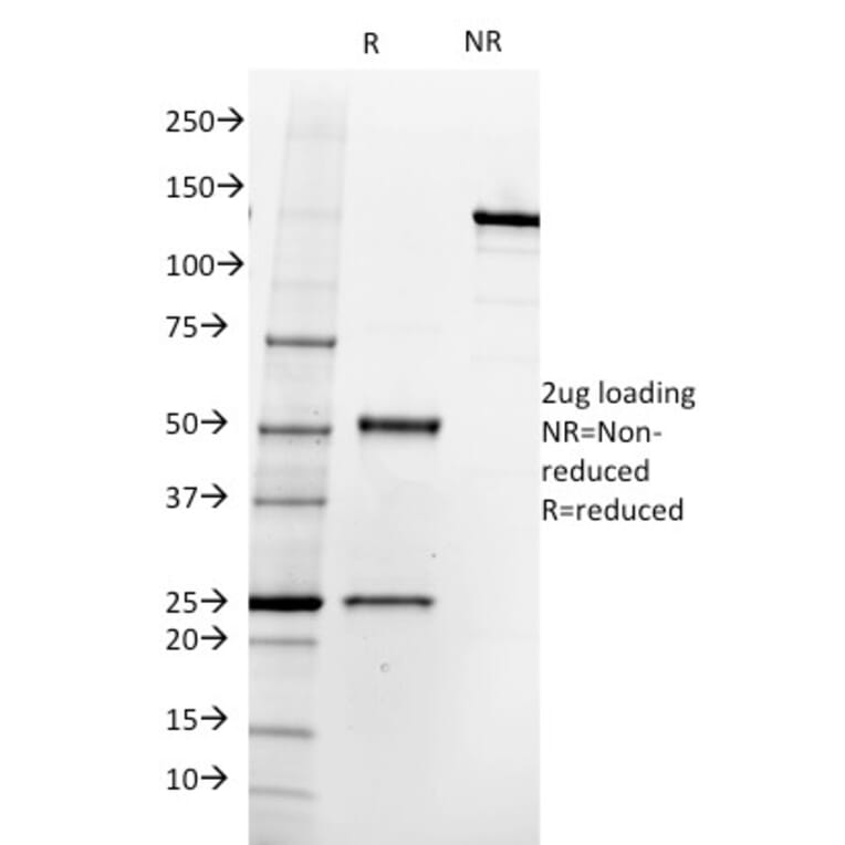 SDS-PAGE - Anti-PSMA Antibody [SPM500] (A248606) - Antibodies.com