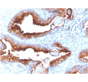 Immunohistochemistry - Anti-PSMA Antibody [FOLH1/3734] (A248608) - Antibodies.com