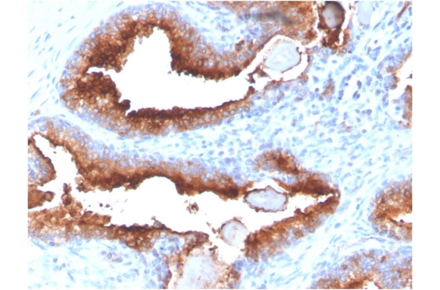 Immunohistochemistry - Anti-PSMA Antibody [FOLH1/3734] (A248608) - Antibodies.com