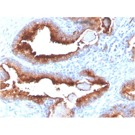Immunohistochemistry - Anti-PSMA Antibody [FOLH1/3734] (A248608) - Antibodies.com