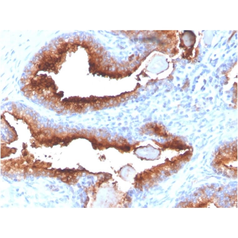 Immunohistochemistry - Anti-PSMA Antibody [FOLH1/3734] (A248608) - Antibodies.com