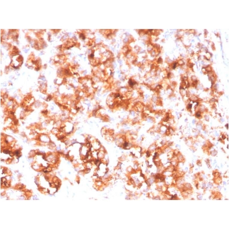 Immunohistochemistry - Anti-PSMA Antibody [FOLH1/3734] (A248608) - Antibodies.com