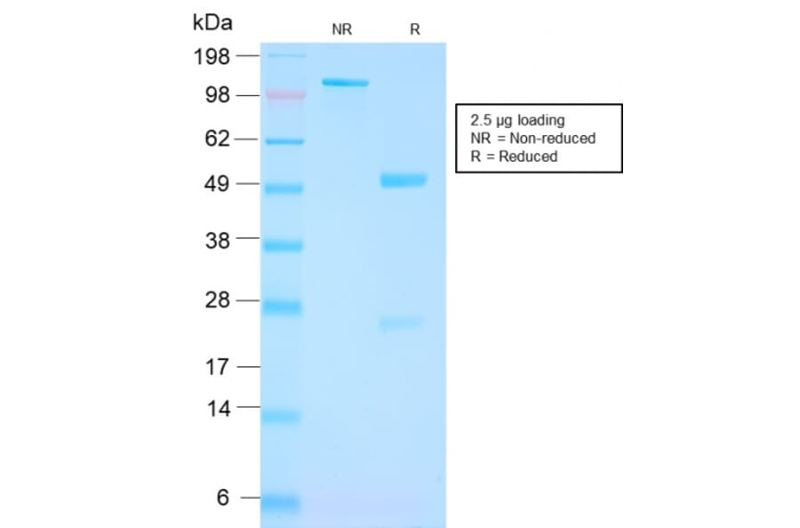 SDS-PAGE - Anti-PSMA Antibody [FOLH1/3149R] (A248609) - Antibodies.com