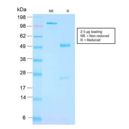 SDS-PAGE - Anti-PSMA Antibody [FOLH1/3149R] (A248609) - Antibodies.com