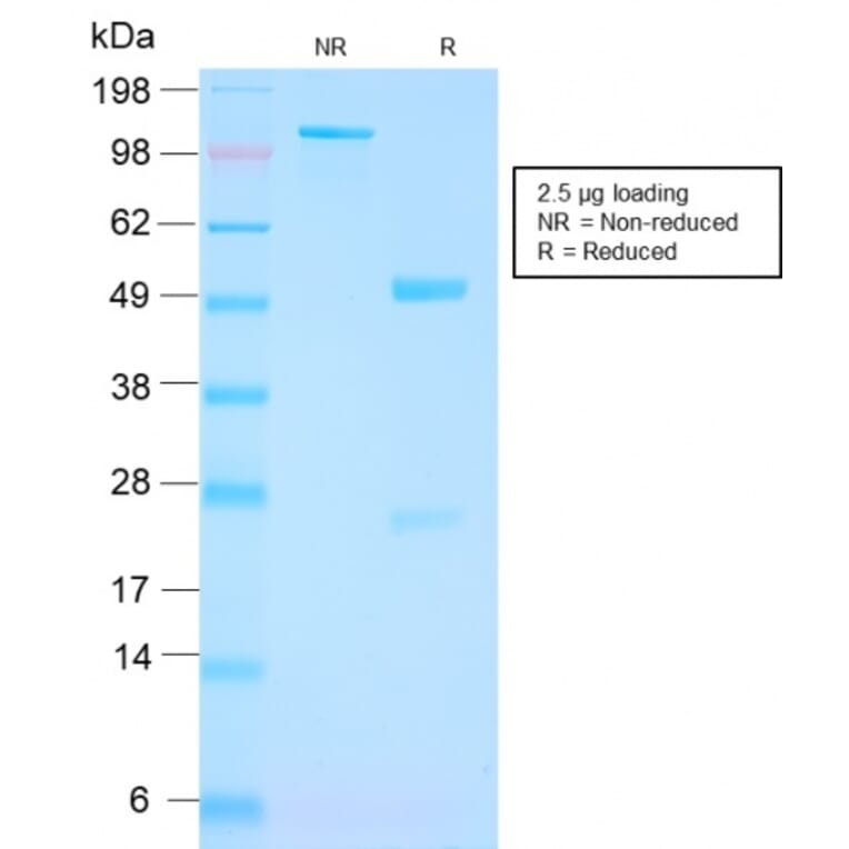 SDS-PAGE - Anti-PSMA Antibody [FOLH1/3149R] (A248609) - Antibodies.com