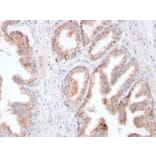 Immunohistochemistry - Anti-PSMA Antibody [FOLH1/3149R] (A248608) - Antibodies.com