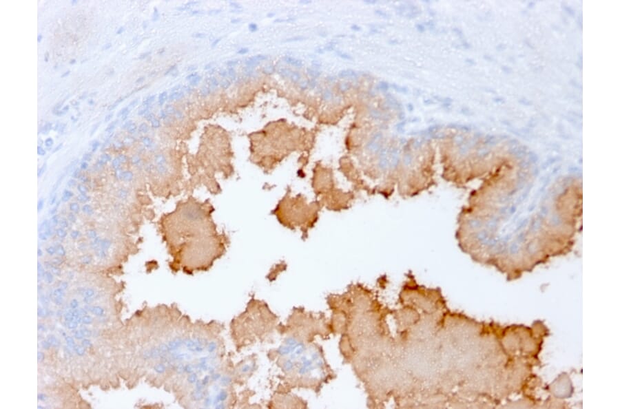 Immunohistochemistry - Anti-AMACR Antibody [rAMACR/1864] (A248611) - Antibodies.com