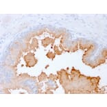 Immunohistochemistry - Anti-AMACR Antibody [rAMACR/1864] (A248611) - Antibodies.com