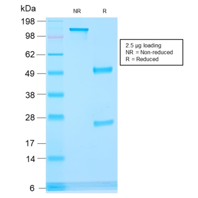 SDS-PAGE - Anti-AMACR Antibody [rAMACR/1864] (A248611) - Antibodies.com