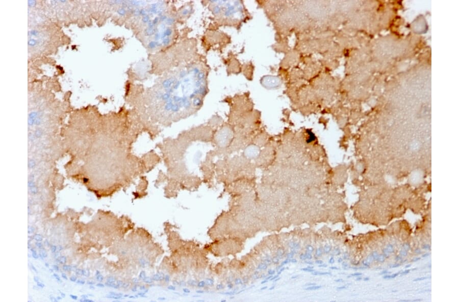 Immunohistochemistry - Anti-AMACR Antibody [rAMACR/1864] (A248610) - Antibodies.com