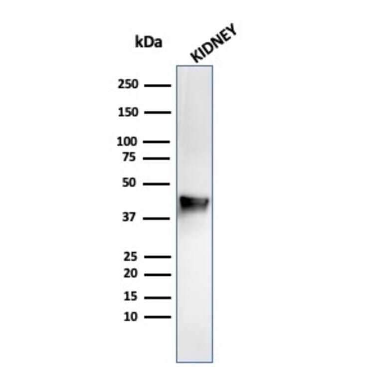 Western Blot - Anti-AMACR Antibody [rAMACR/1864] (A248611) - Antibodies.com