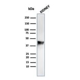 Western Blot - Anti-AMACR Antibody [rAMACR/1864] (A248611) - Antibodies.com
