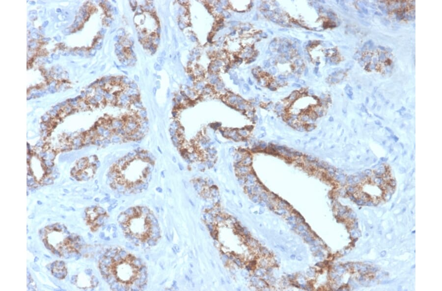 Immunohistochemistry - Anti-AMACR Antibody [rAMACR/4674] (A248611) - Antibodies.com