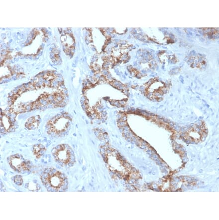 Immunohistochemistry - Anti-AMACR Antibody [rAMACR/4674] (A248611) - Antibodies.com