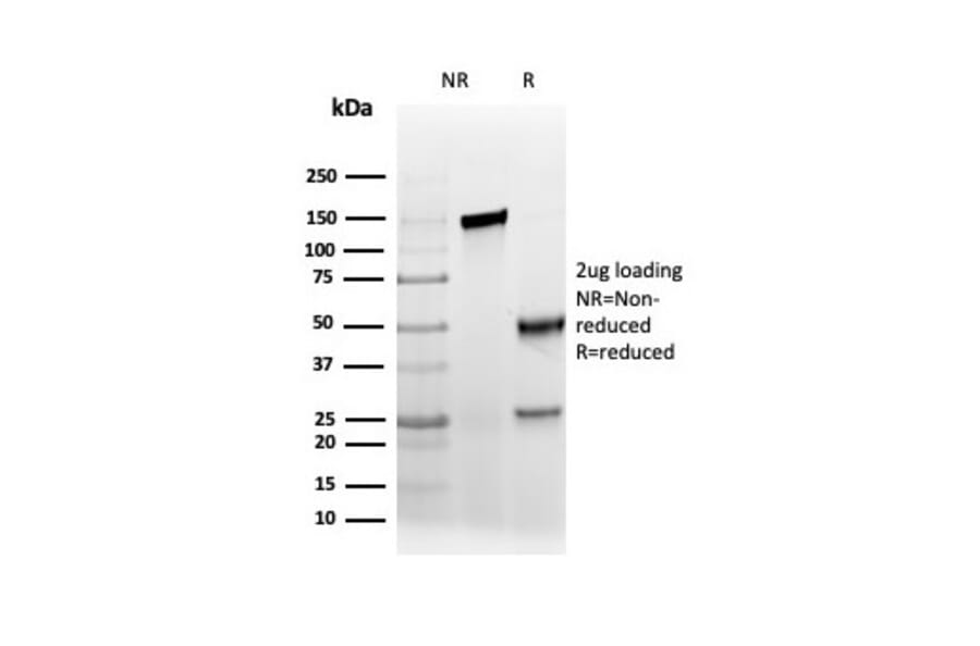 SDS-PAGE - Anti-AMACR Antibody [rAMACR/6369] (A248613) - Antibodies.com
