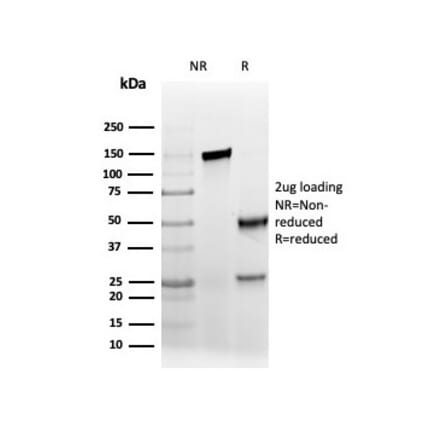 SDS-PAGE - Anti-AMACR Antibody [rAMACR/6369] (A248613) - Antibodies.com