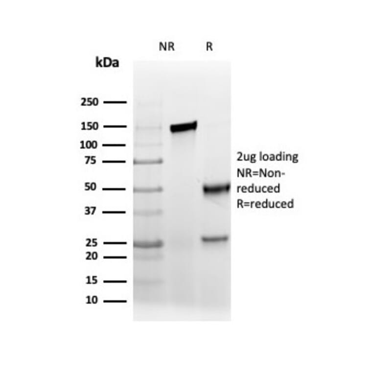 SDS-PAGE - Anti-AMACR Antibody [rAMACR/6369] (A248613) - Antibodies.com