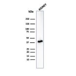 Western Blot - Anti-AMACR Antibody [rAMACR/6369] (A248613) - Antibodies.com