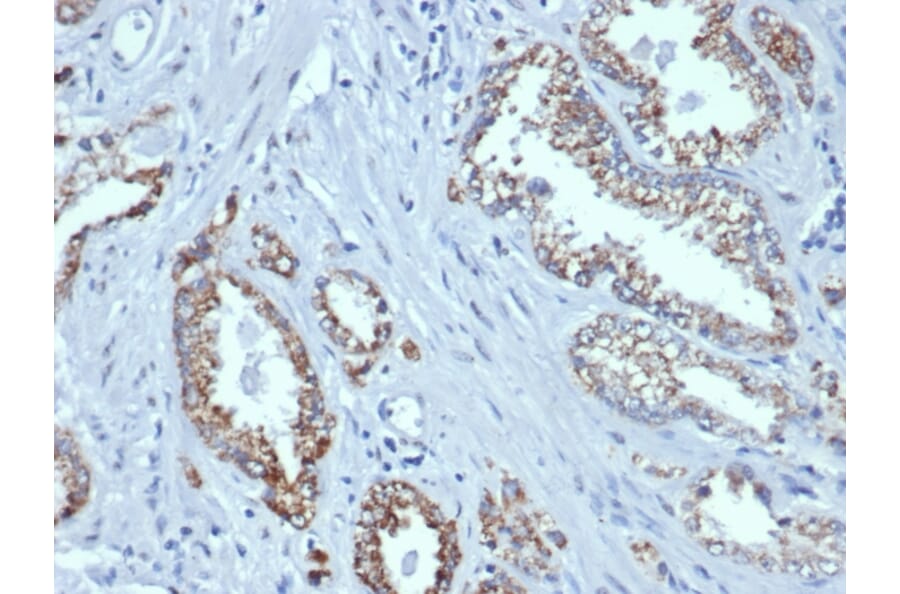 Immunohistochemistry - Anti-AMACR Antibody [rAMACR/6369] (A248612) - Antibodies.com