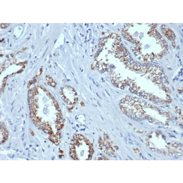 Immunohistochemistry - Anti-AMACR Antibody [rAMACR/6369] (A248612) - Antibodies.com