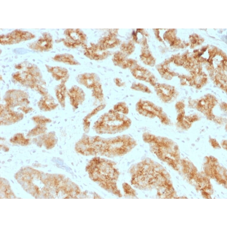 Immunohistochemistry - Anti-AMACR Antibody [AMACR/1723] (A248613) - Antibodies.com