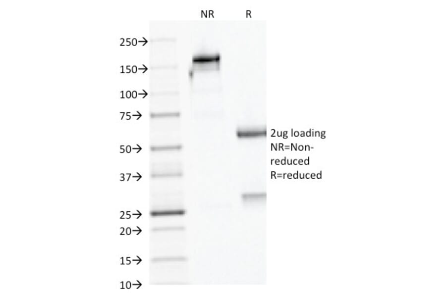 SDS-PAGE - Anti-AMACR Antibody [AMACR/1723] (A248614) - Antibodies.com