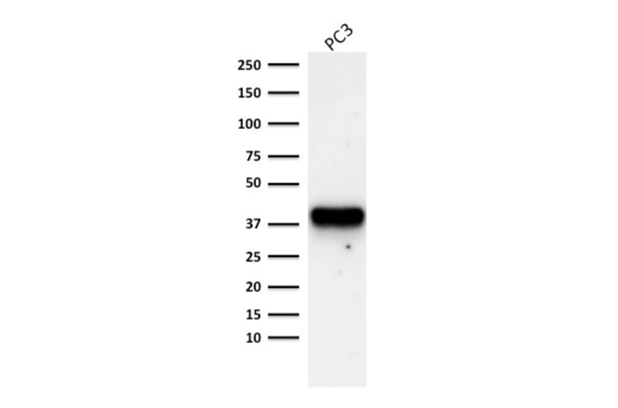 Western Blot - Anti-AMACR Antibody [AMACR/1723] (A248614) - Antibodies.com
