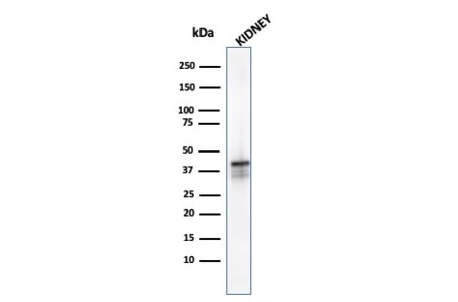 Western Blot - Anti-AMACR Antibody [AMACR/1723] (A248614) - Antibodies.com