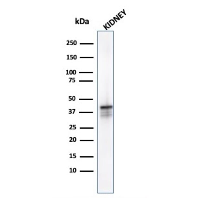 Western Blot - Anti-AMACR Antibody [AMACR/1723] (A248614) - Antibodies.com