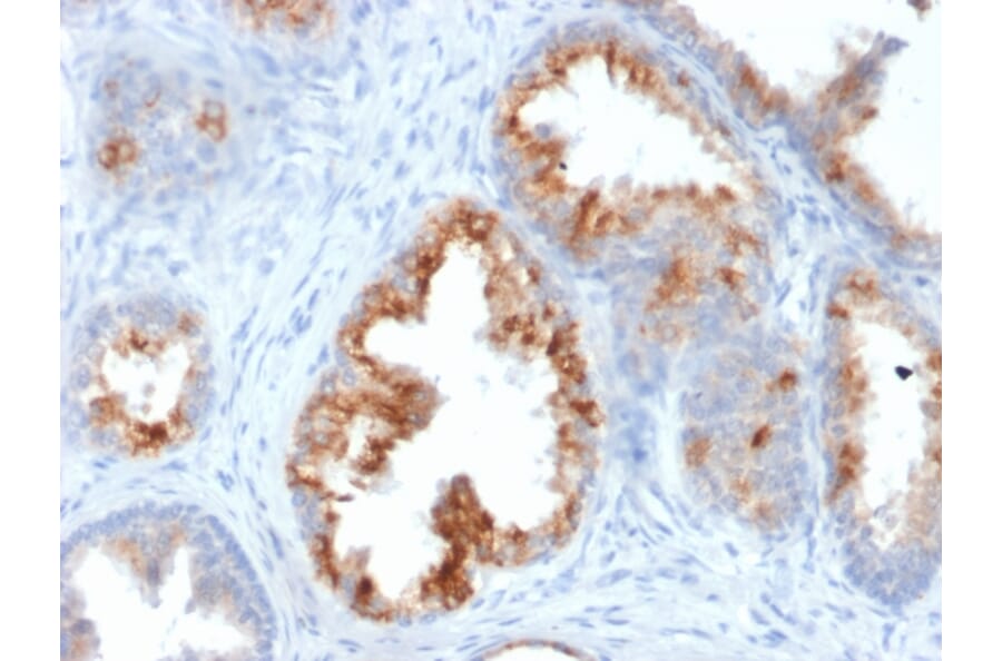 Immunohistochemistry - Anti-AMACR Antibody [AMACR/1864] (A248615) - Antibodies.com