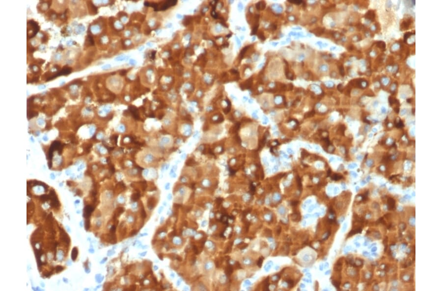 Immunohistochemistry - Anti-AMACR Antibody [AMACR/1864] (A248615) - Antibodies.com