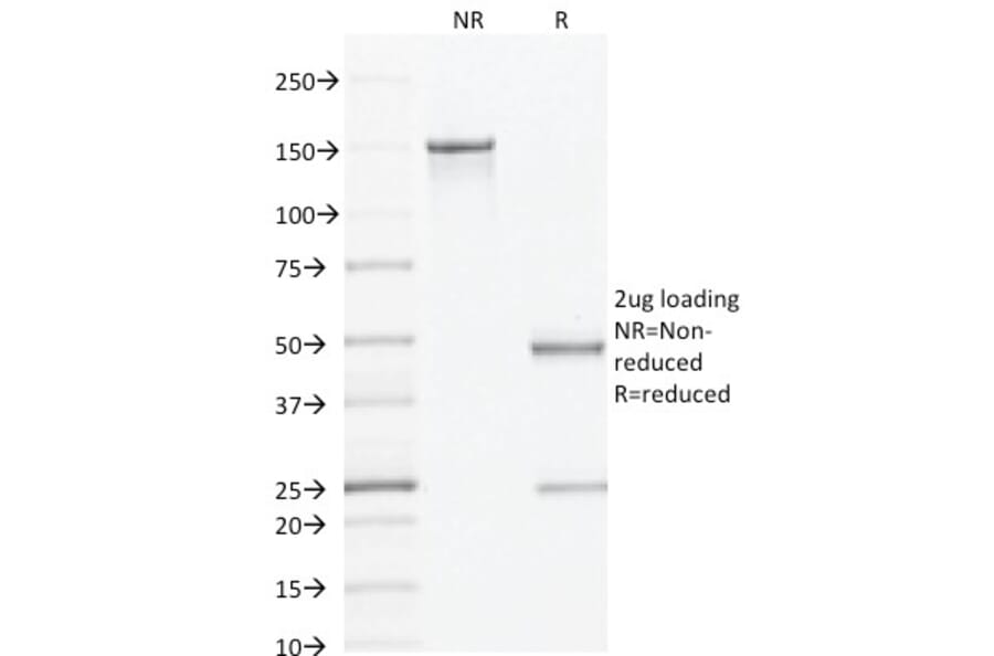 SDS-PAGE - Anti-AMACR Antibody [AMACR/1864] (A248615) - Antibodies.com