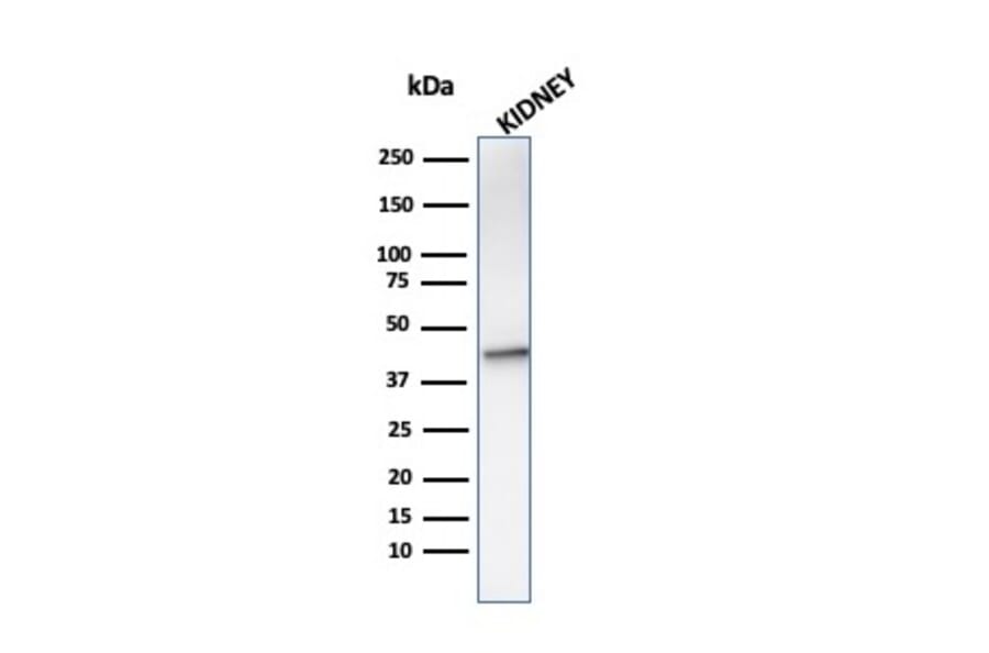 Western Blot - Anti-AMACR Antibody [AMACR/1864] (A248615) - Antibodies.com