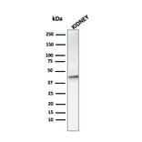 Western Blot - Anti-AMACR Antibody [AMACR/1864] (A248615) - Antibodies.com