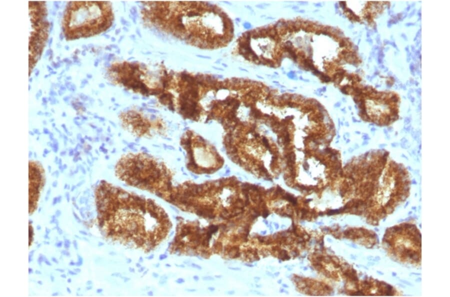 Immunohistochemistry - Anti-AMACR Antibody [AMACR/3931R] (A248615) - Antibodies.com