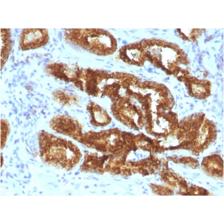 Immunohistochemistry - Anti-AMACR Antibody [AMACR/3931R] (A248615) - Antibodies.com