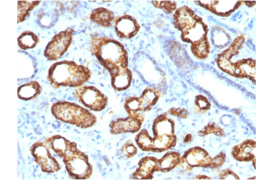 Immunohistochemistry - Anti-AMACR Antibody [AMACR/3931R] (A248616) - Antibodies.com