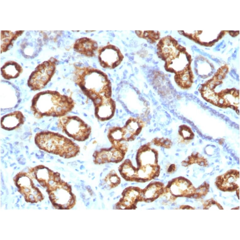 Immunohistochemistry - Anti-AMACR Antibody [AMACR/3931R] (A248616) - Antibodies.com