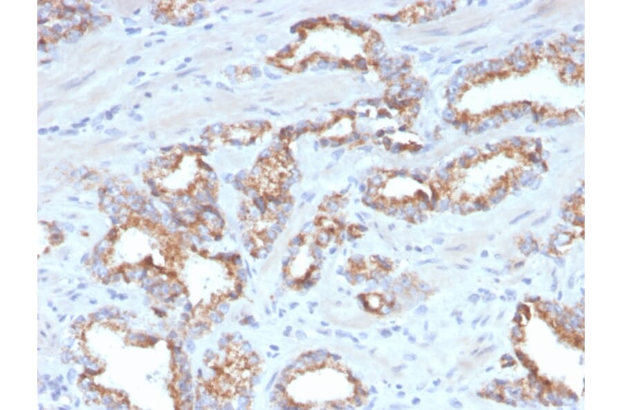 Immunohistochemistry - Anti-AMACR Antibody [AMACR/4572R] (A248617) - Antibodies.com
