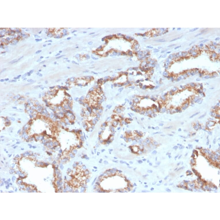 Immunohistochemistry - Anti-AMACR Antibody [AMACR/4572R] (A248617) - Antibodies.com