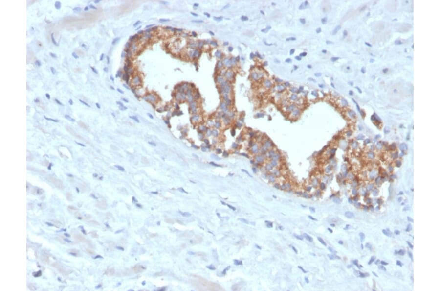Immunohistochemistry - Anti-AMACR Antibody [AMACR/4572R] (A248616) - Antibodies.com