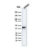 Western Blot - Anti-AMACR Antibody [AMACR/4572R] (A248617) - Antibodies.com